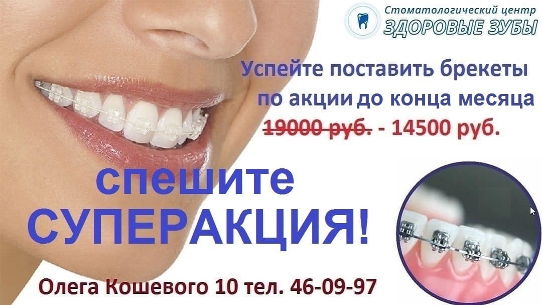 Преимущества и недостатки рассрочки на ортодонтическое лечение