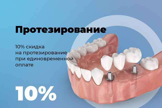 Протез импланта. 